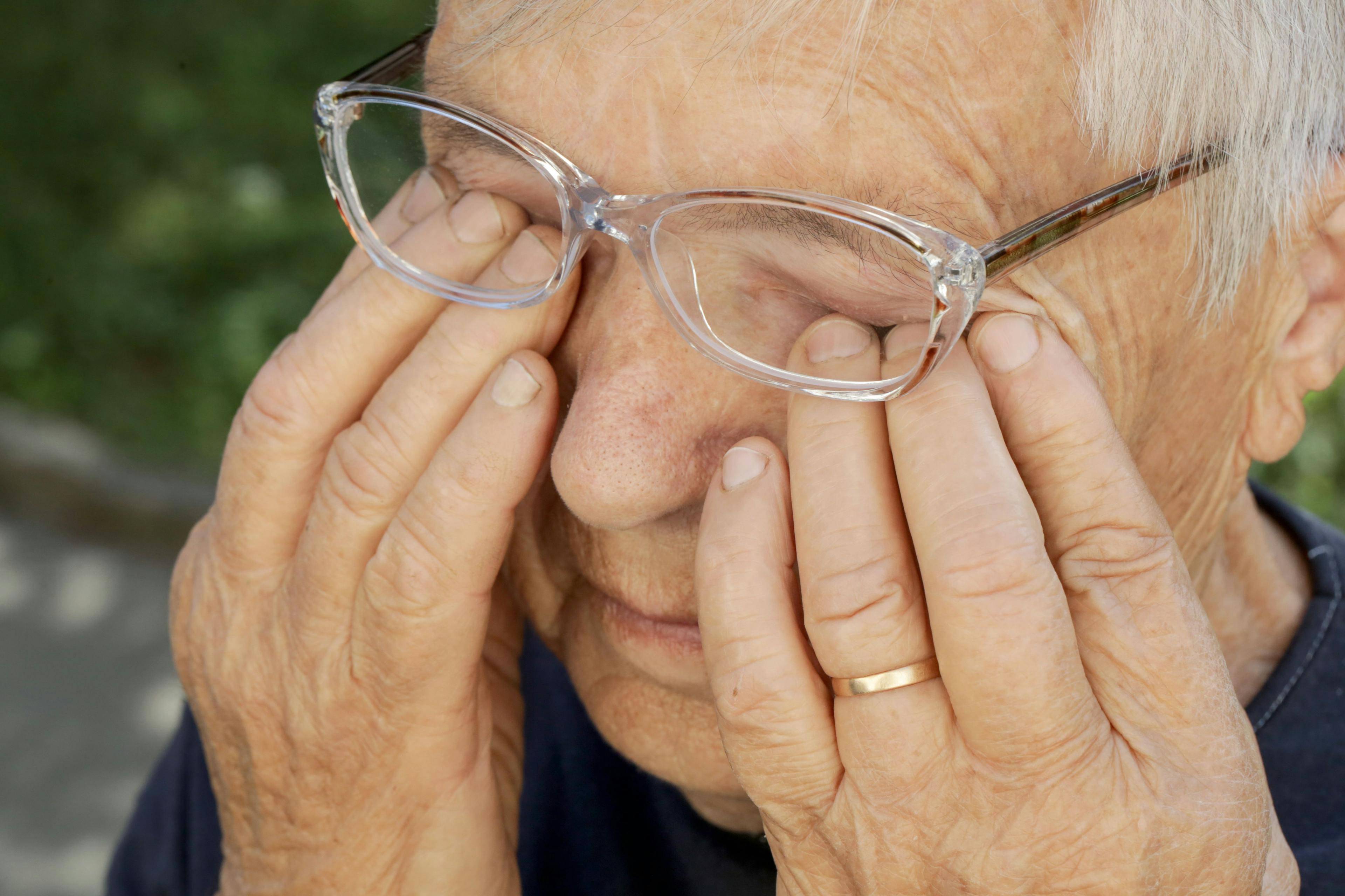 person rubbing their eyes under glasses | Image credit: ©triocean stock.adobe.com