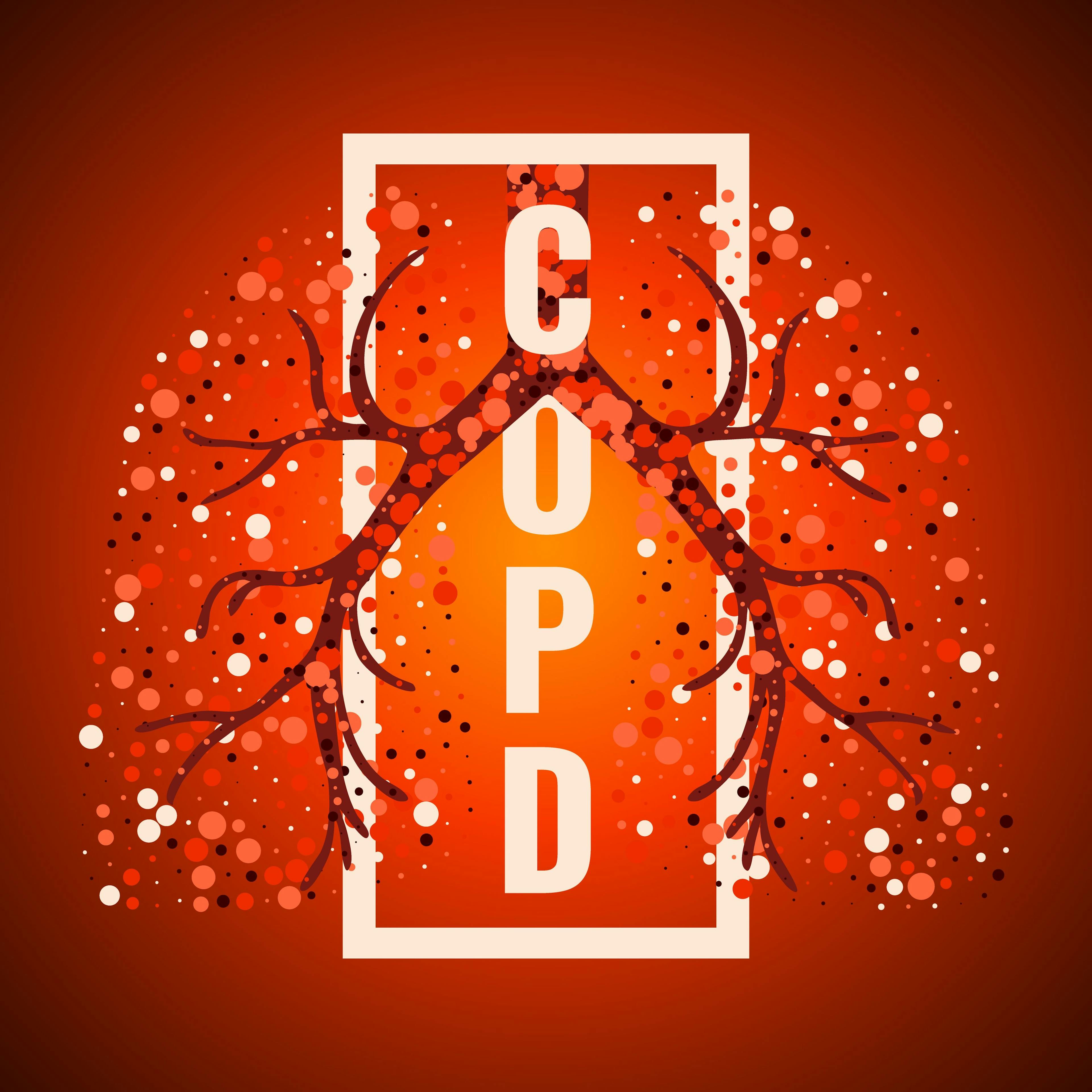 COPD letters on red background | Image credit: © art4stock  stock.adobe.com