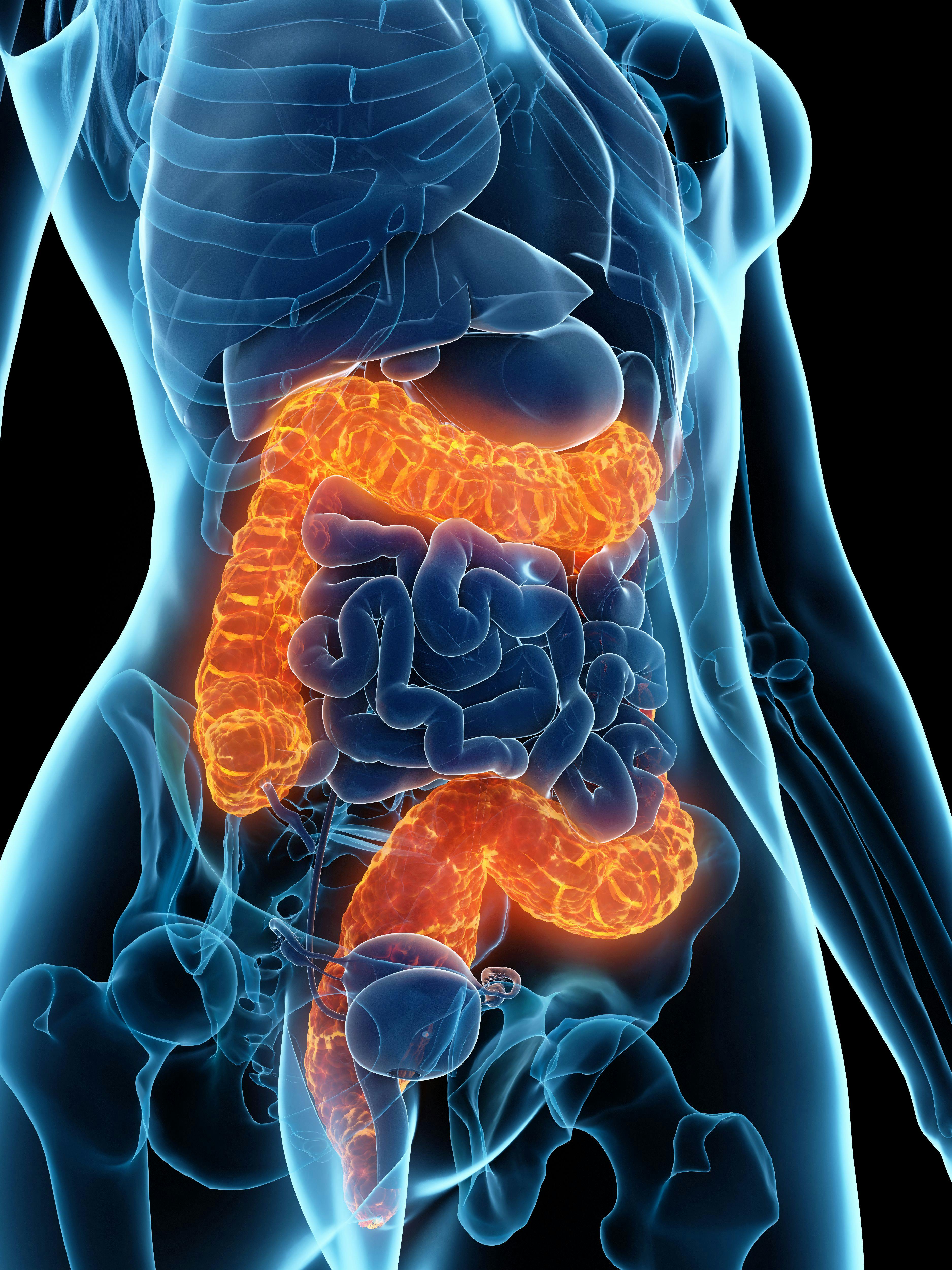 female figure with bowel highlighted | Image credit: © Sebastian Kaulitzski  stock.adobe.com