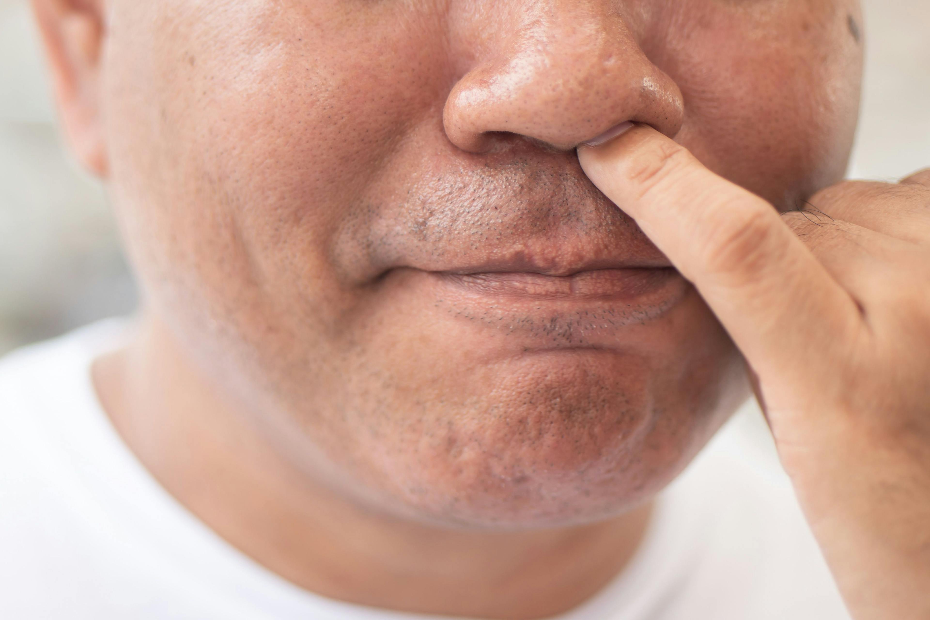 Nose Picking Raises Concern: Healthcare Workers at Higher Risk for COVID-19 Transmission