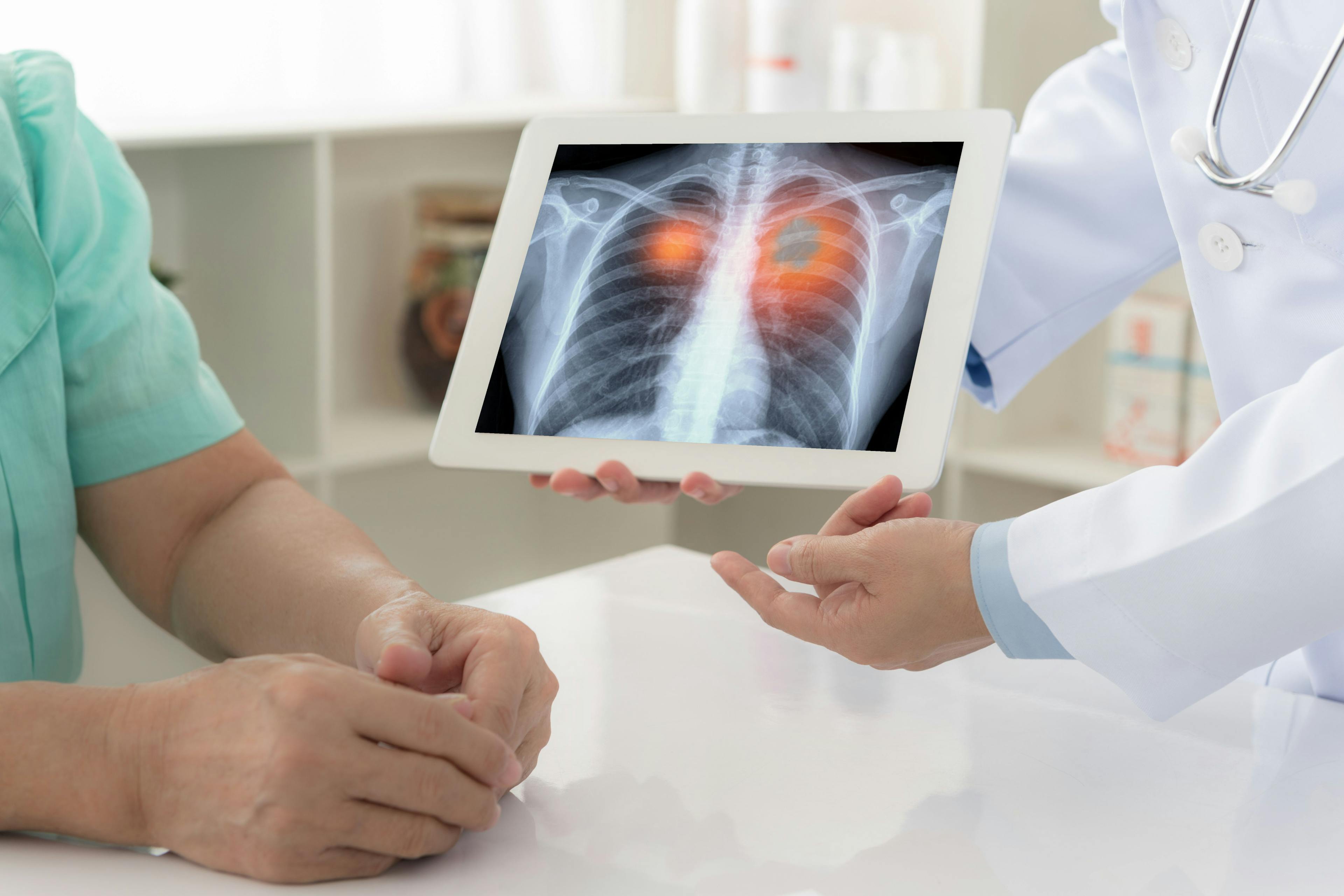 doctor showing patient lung cancer image | Image credit: ©utah51  stock.adobe.com
