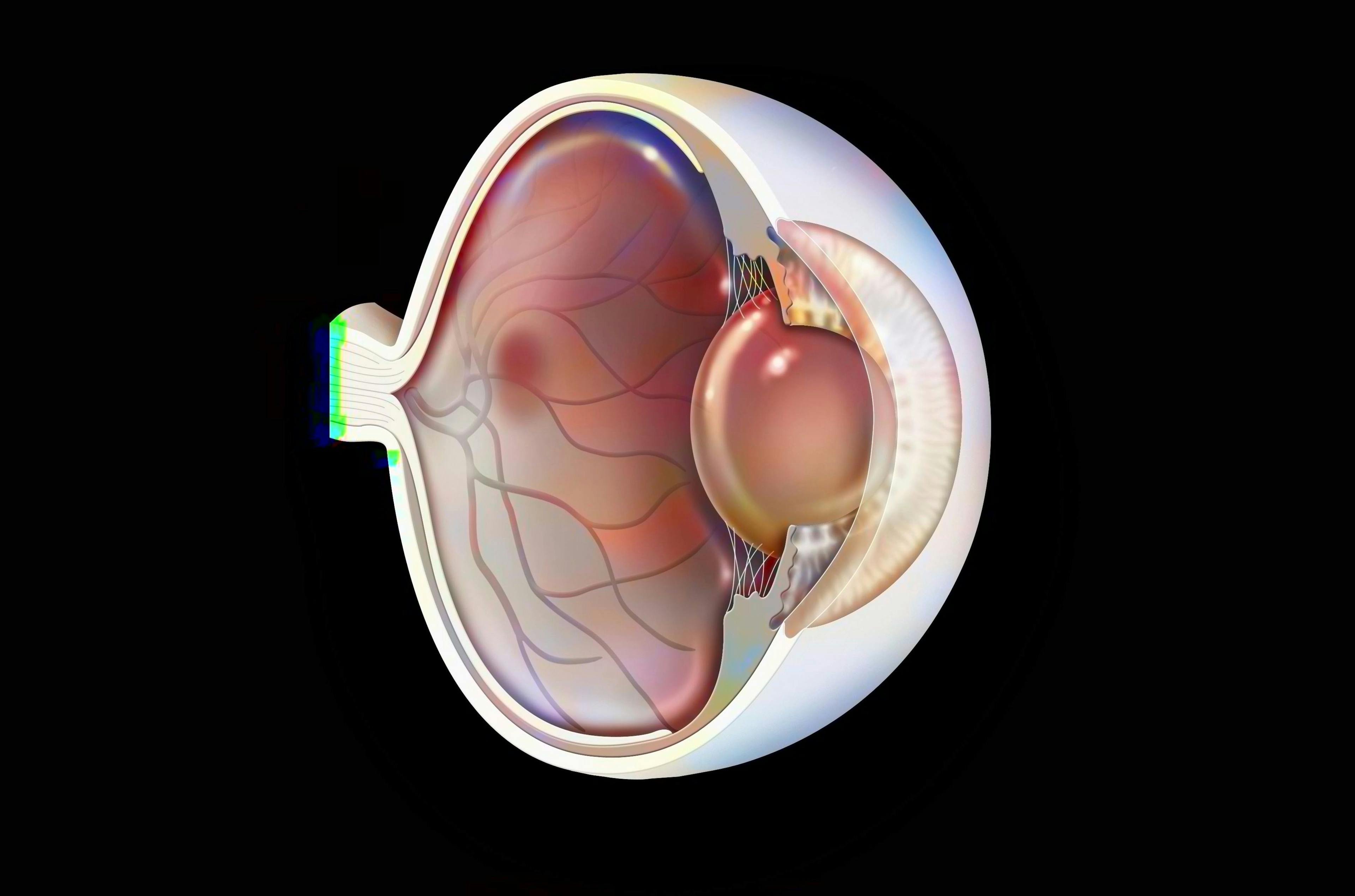 Eye with macular degeneration | Image credit: RFBSIP