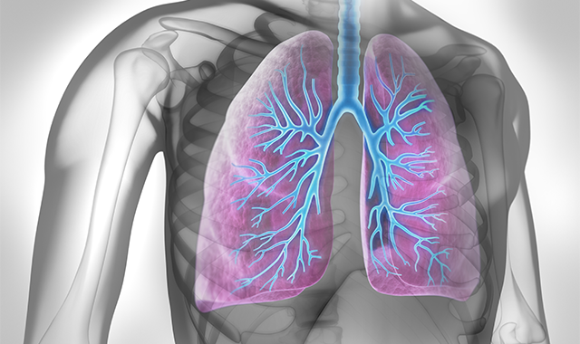 FDA clears first treatment for mesothelioma in 16 years
