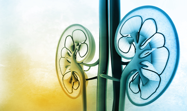 Transforming Care for Chronic Kidney and End-Stage Renal Disease Patients 