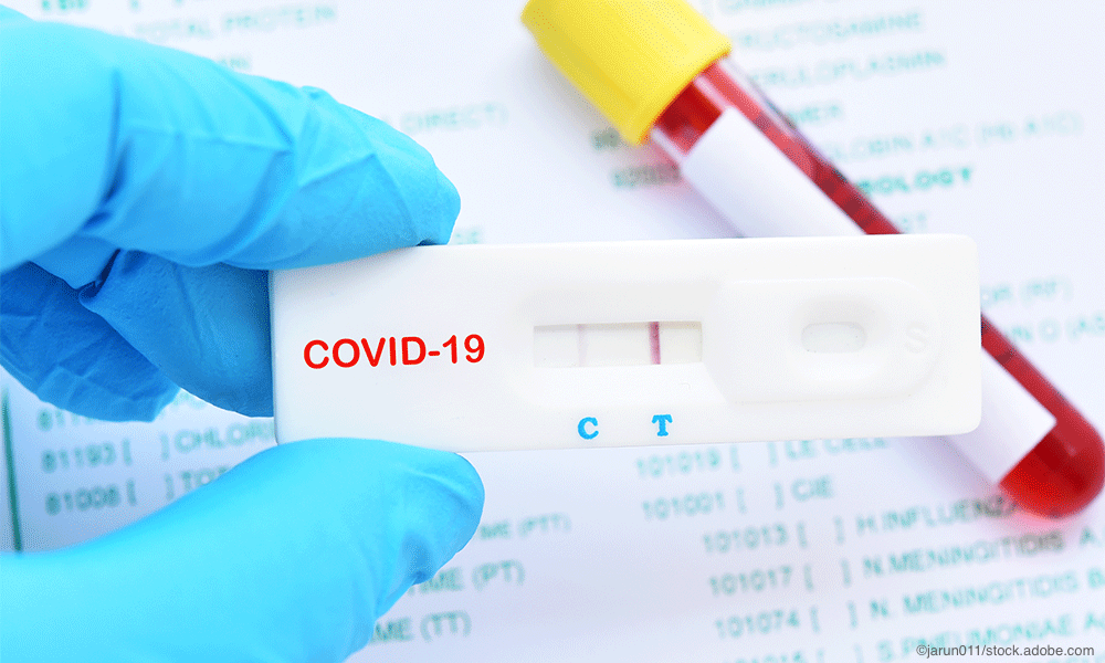 FDA OK's 10-min COVID-19 Antigen Test