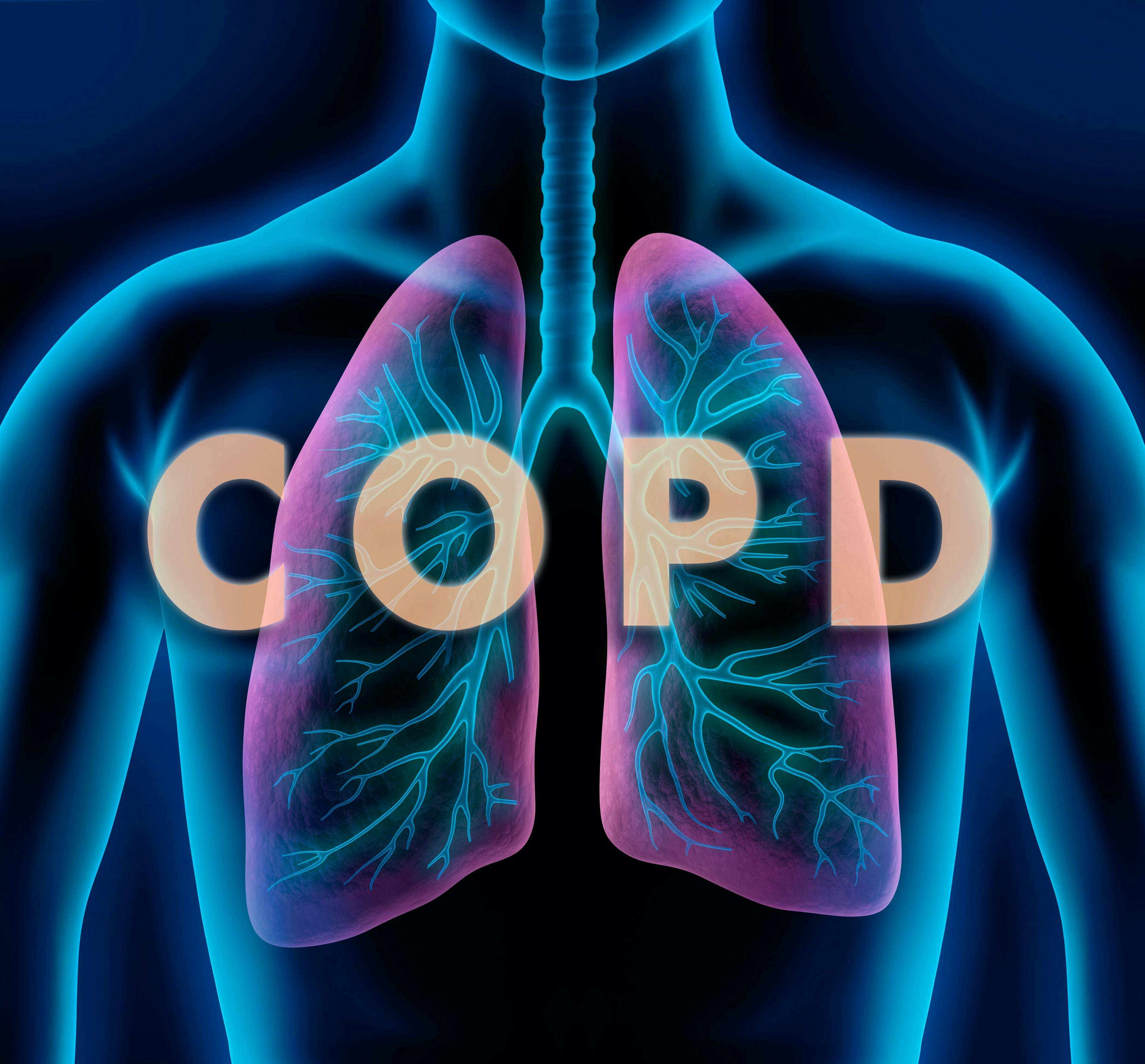 lung image with letters COPD | Image credit: © peterschreiber.media. stock.adobe.com