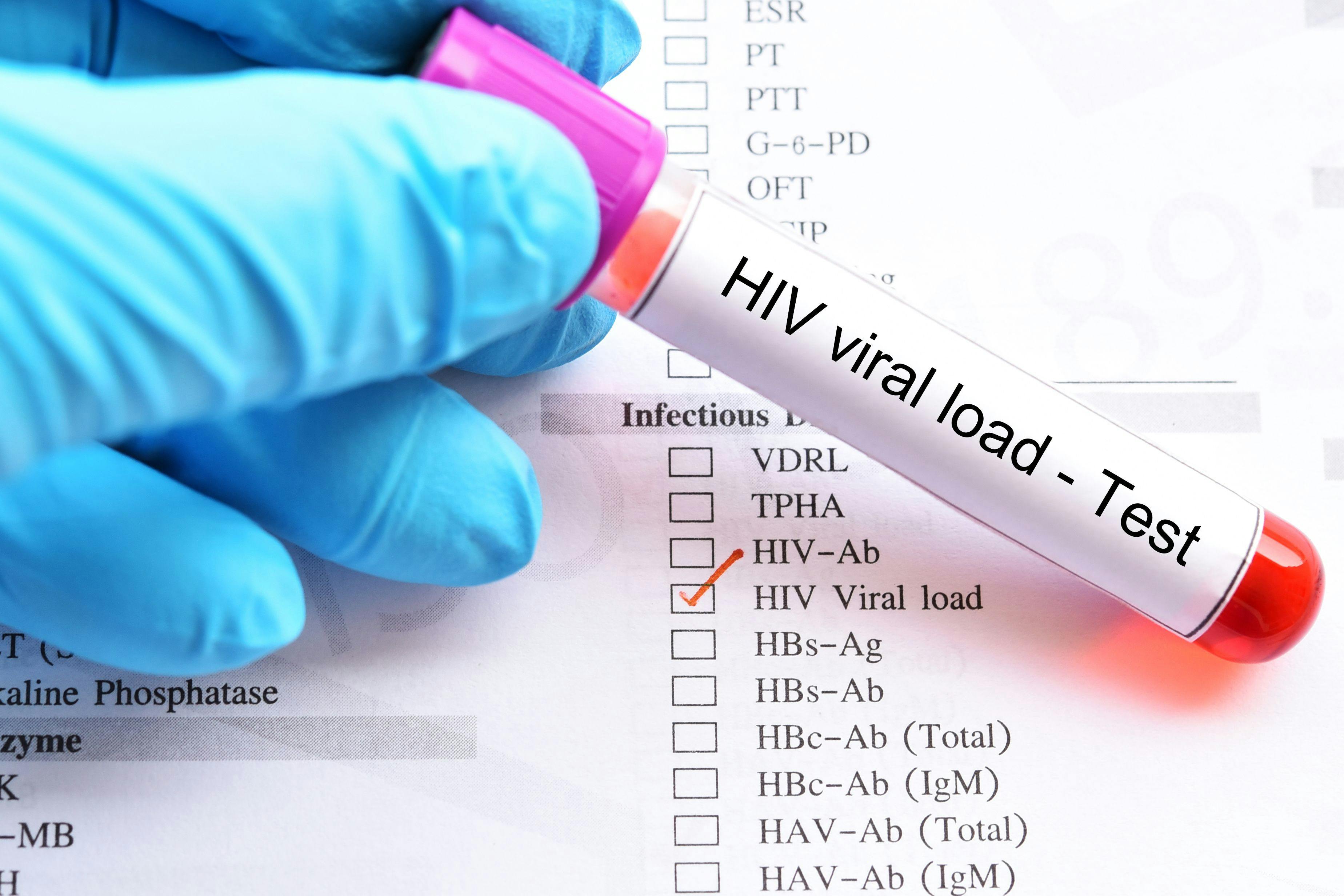 The Risk Of Sexual Transmission Of HIV From Individuals With Low-Level HIV Viremia