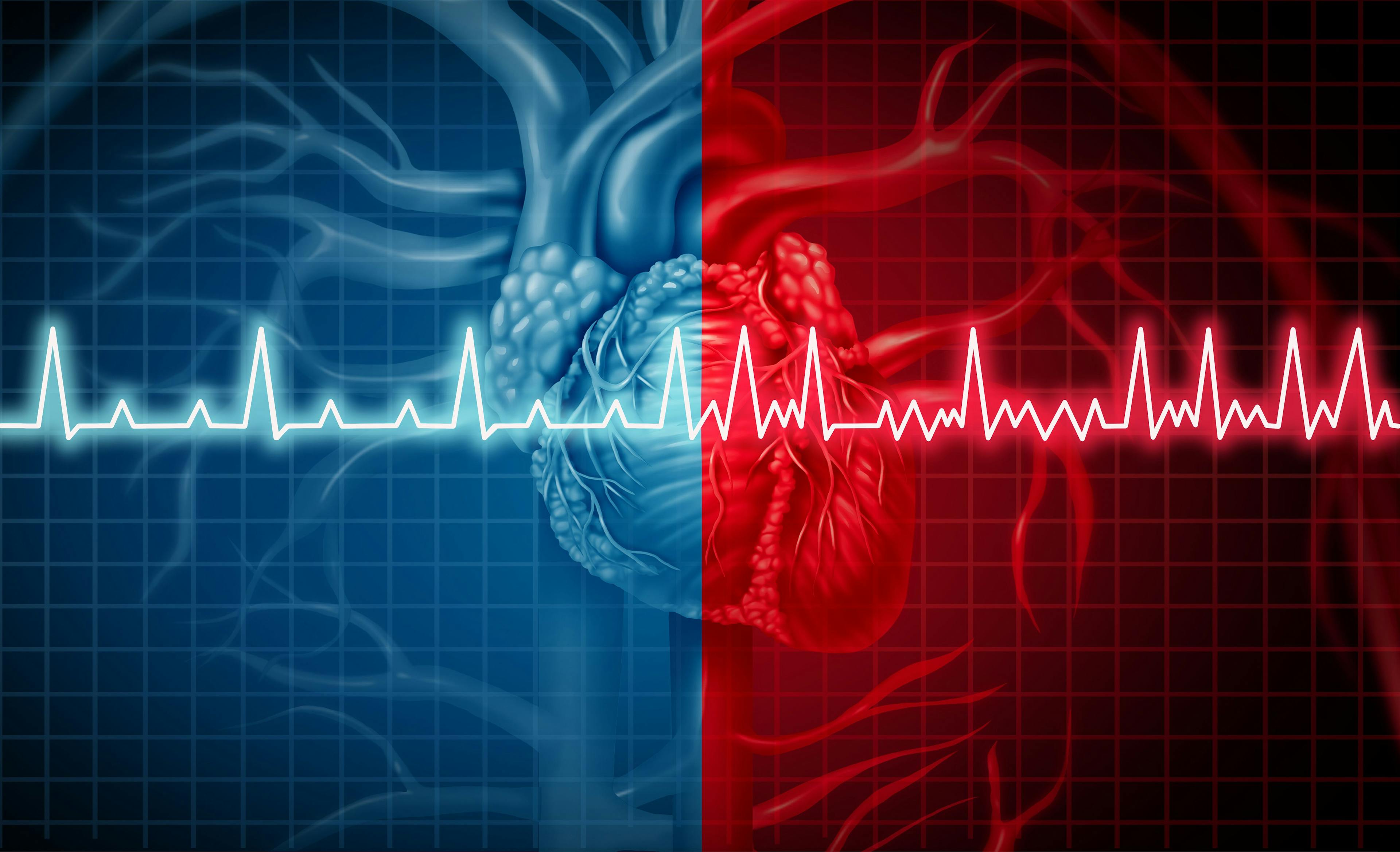 Disease-associated Genetic Variants Common Among Those With Early-onset Afib, Study Finds