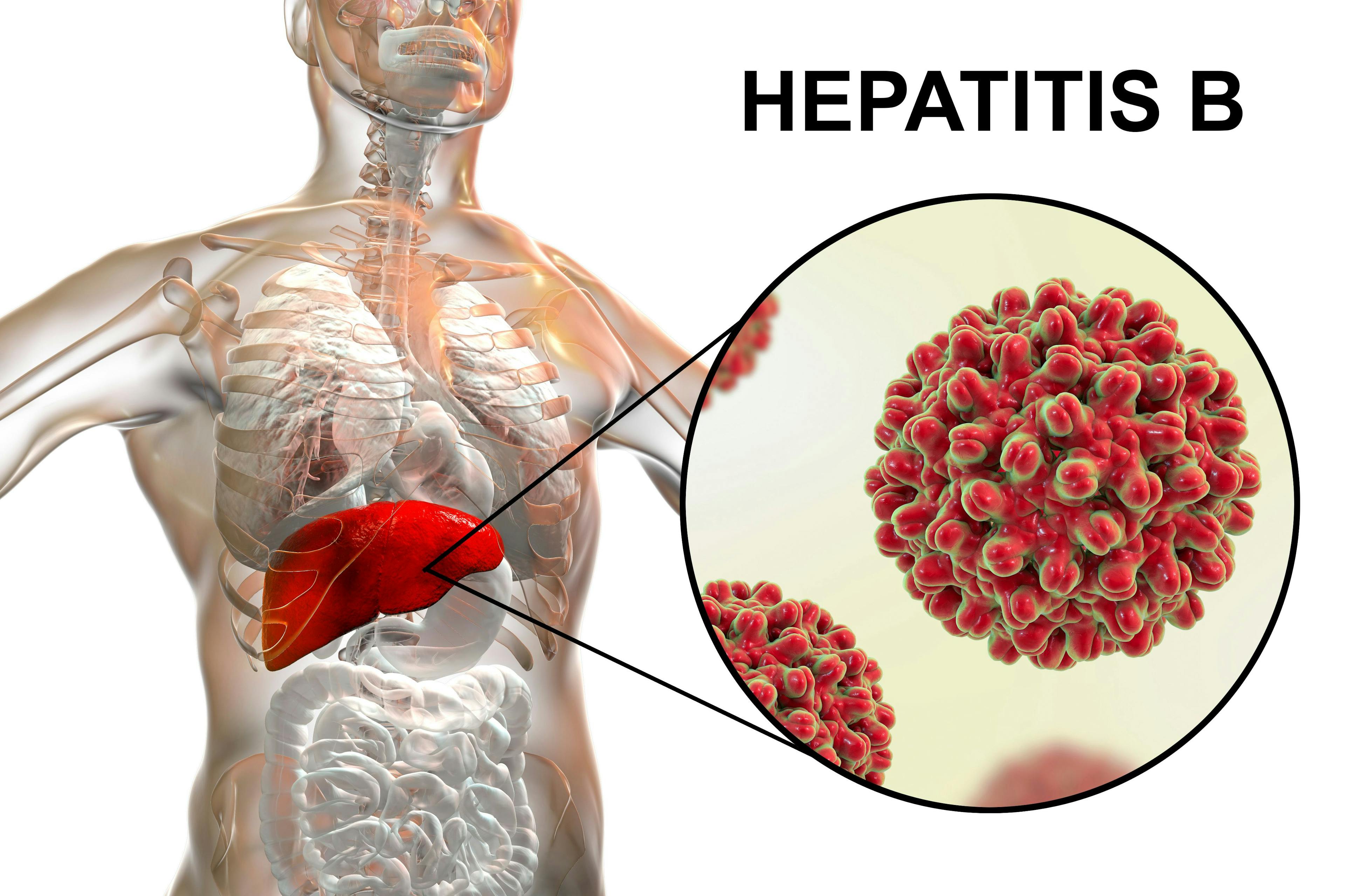 medical image. of liver and hep B virus | Dr_Microbe