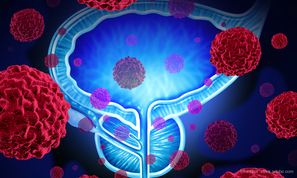 What's New in Prostate Cancer Treatment