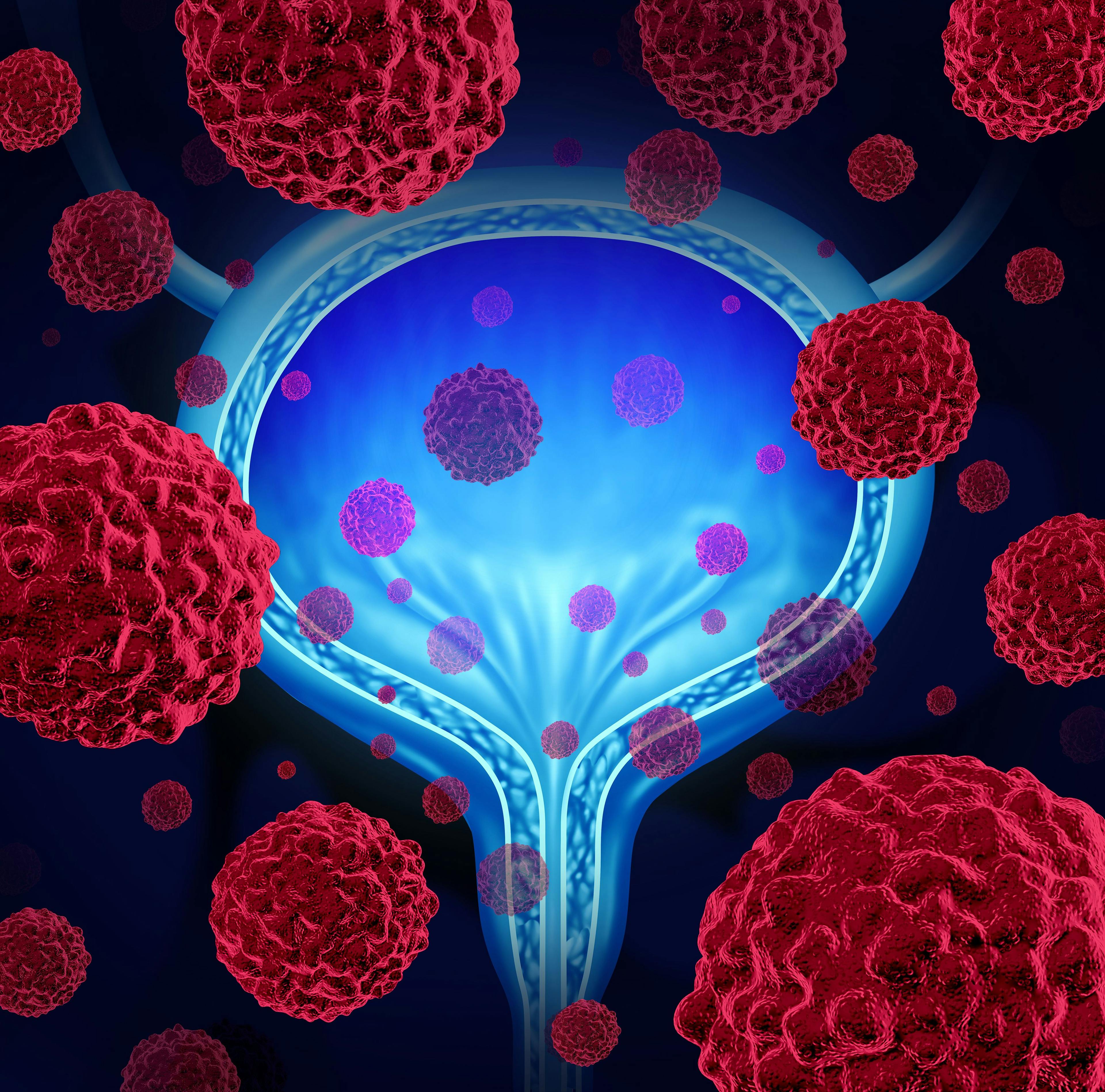 Padvec Prolongs Survival in Locally Advanced or Metastatic Urothelial Carcinoma 