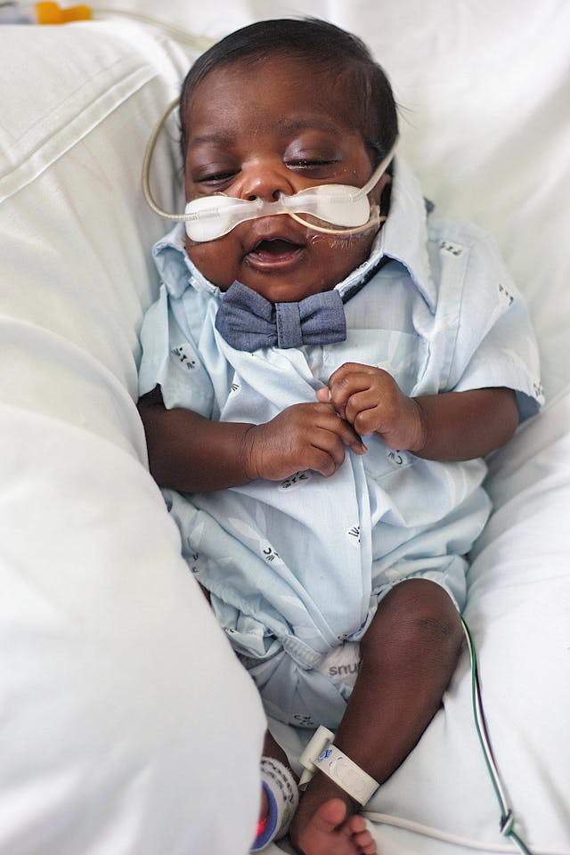 Preterm infant mortality in the U.S. has dropped, but remains high for Black infants