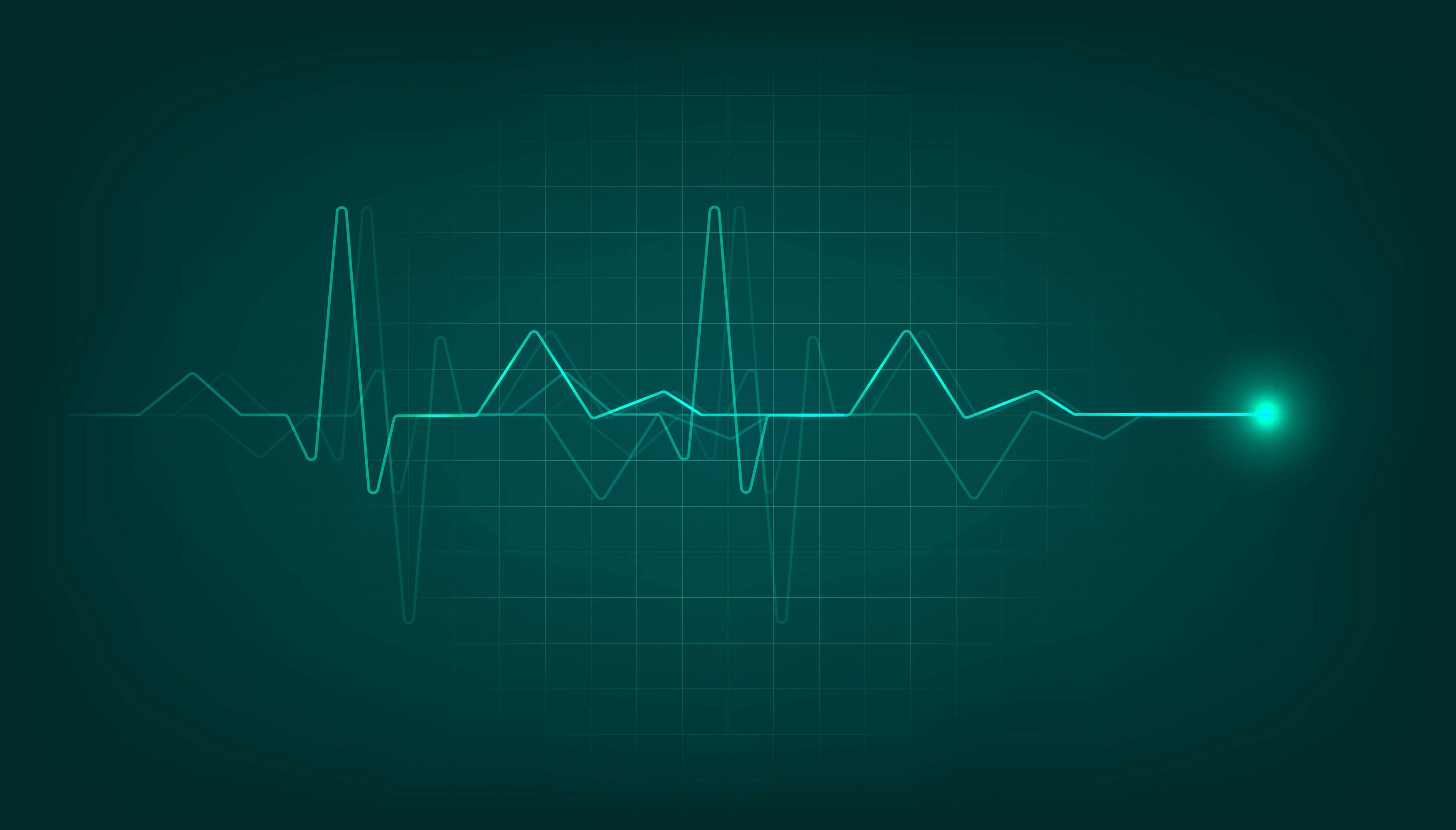 Using AI to improve ECG data capture on portable devices