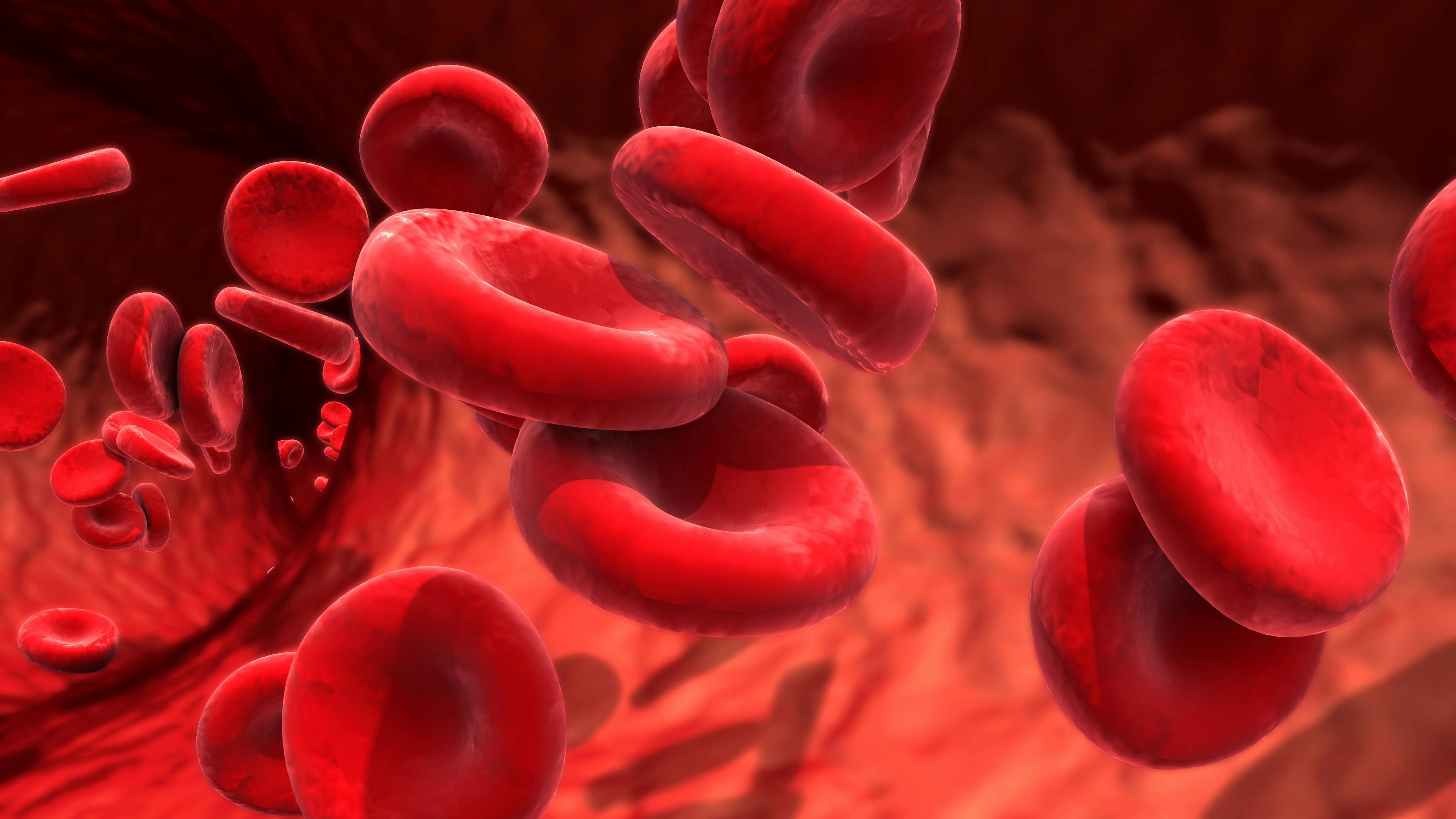 Hemoglobin Could be a Biomarker in COPD