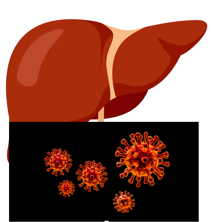 COVID-19 Poses Special Risk for People With Chronic Liver Disease