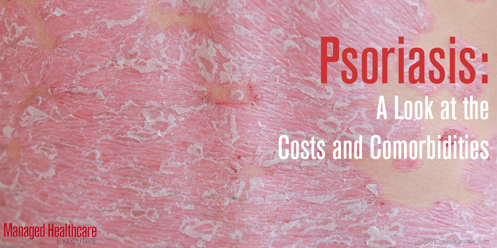 Six Ways Psoriasis Costs Extend Well Beyond Treatment of One Condition