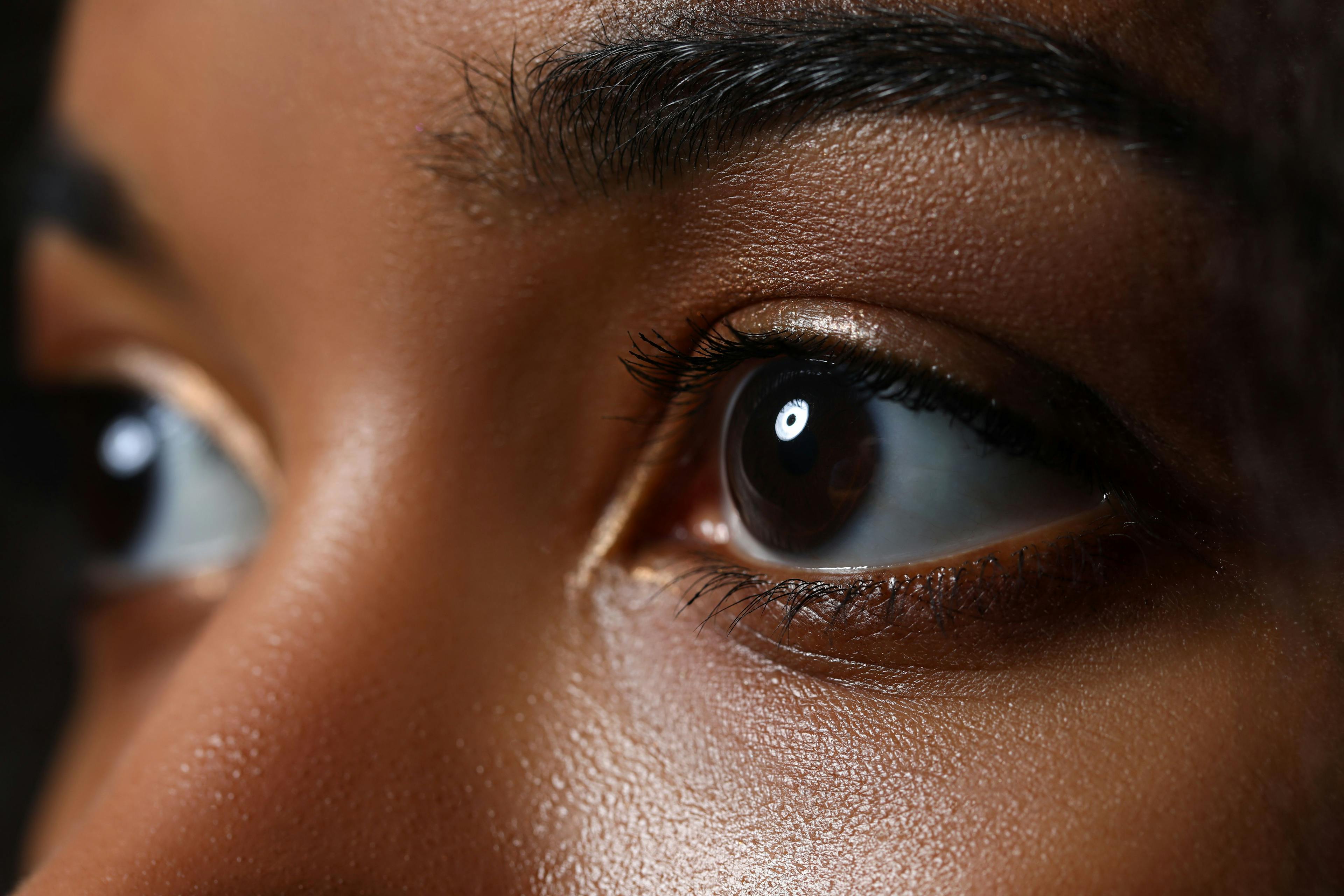 Healthcare Disparities in the US Amongst Those of Color With Glaucoma