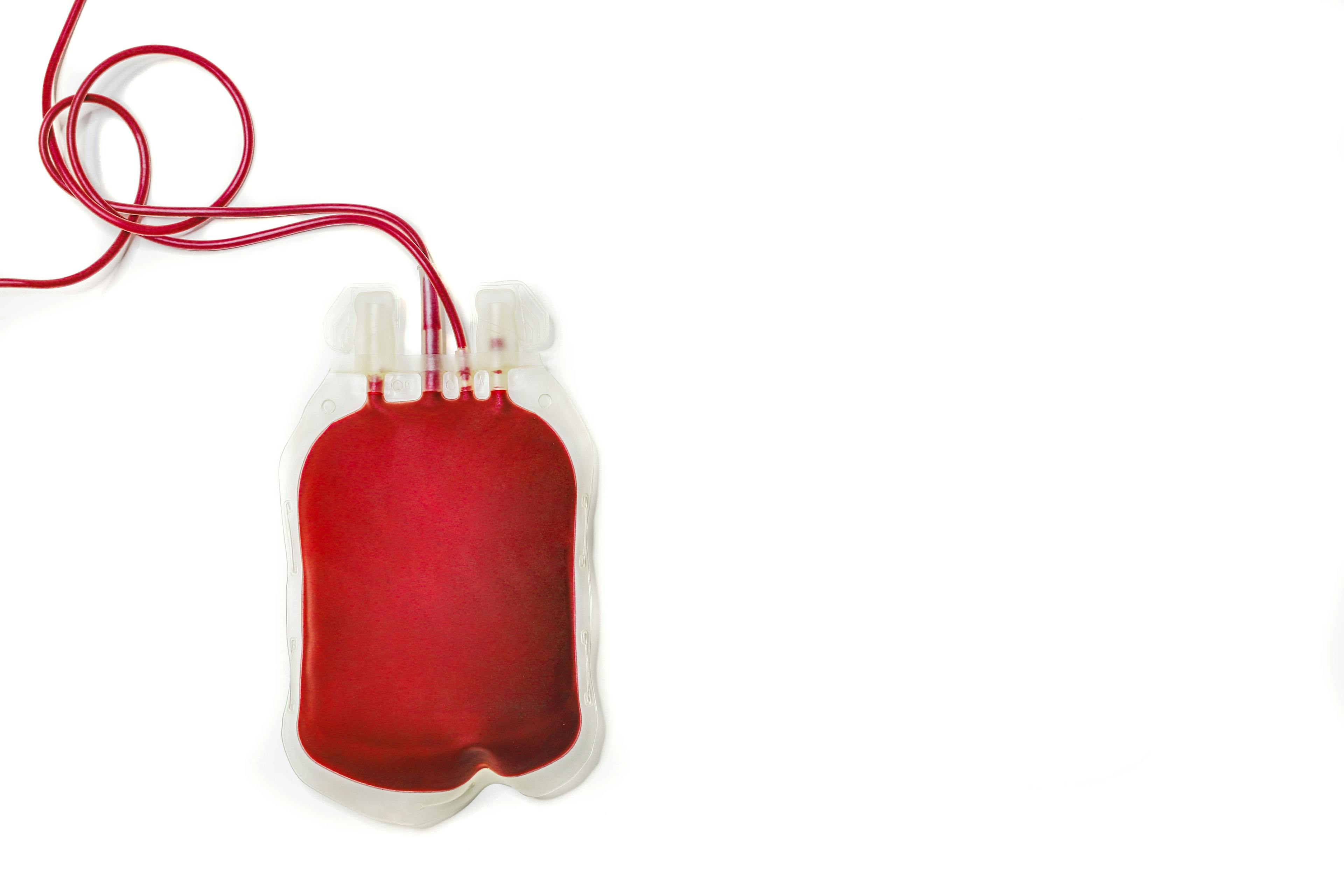 Blood donation bag | Image credit: SOPONE - stock.adobe.com