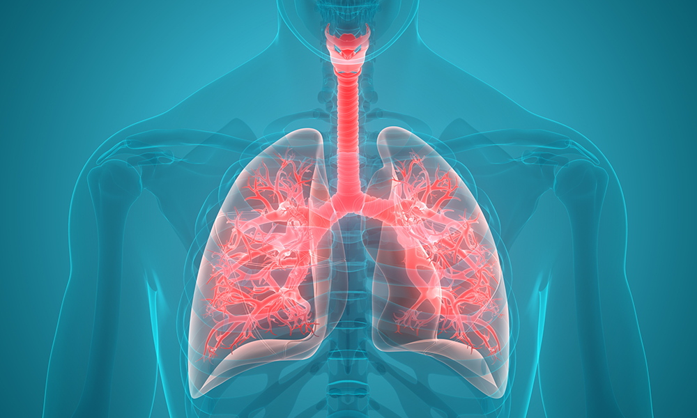 Study Identified 25 Genetic Variants Linked with Lung Cancer Risk