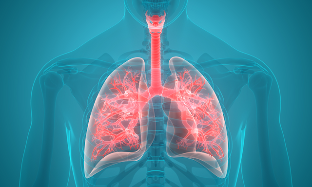 Study Identified 25 Genetic Variants Linked with Lung Cancer Risk