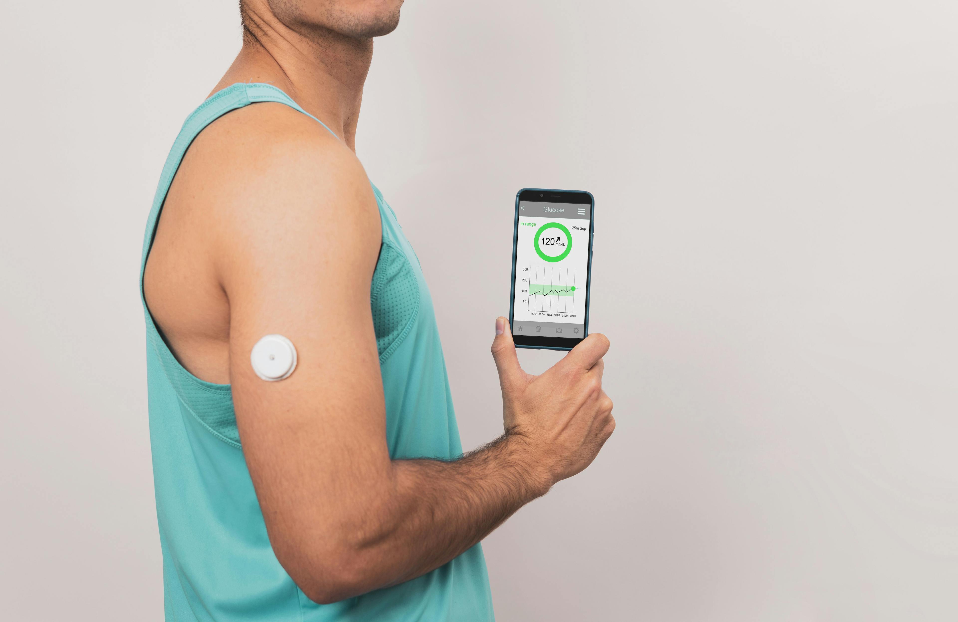 Man with continuous glucose monitor sensor in arm | Image credit: © Yistocking  stock.adobe.com
