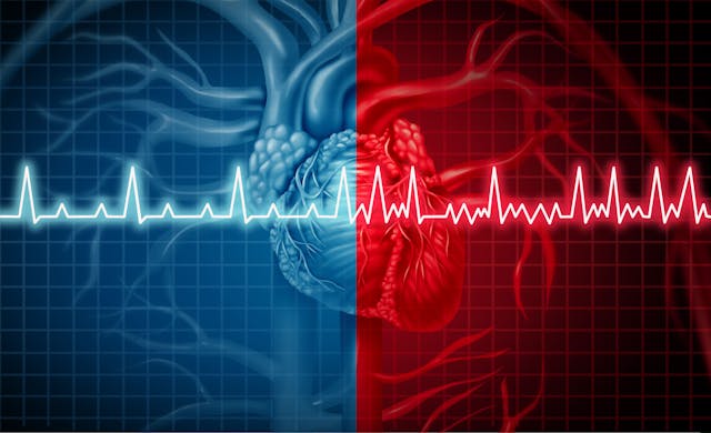 The Rise of Atrial Fibrillation Has More Than Doubled Over 30 Years