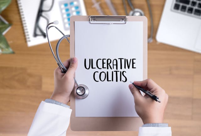 FDA Approves Oral Velsipity for Ulcerative Colitis 