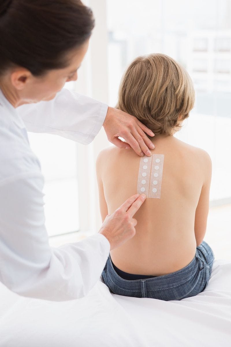 Doctor performing a patch test on a child.

Image credit: WavebreakMediaMicro - stock.adobe.com