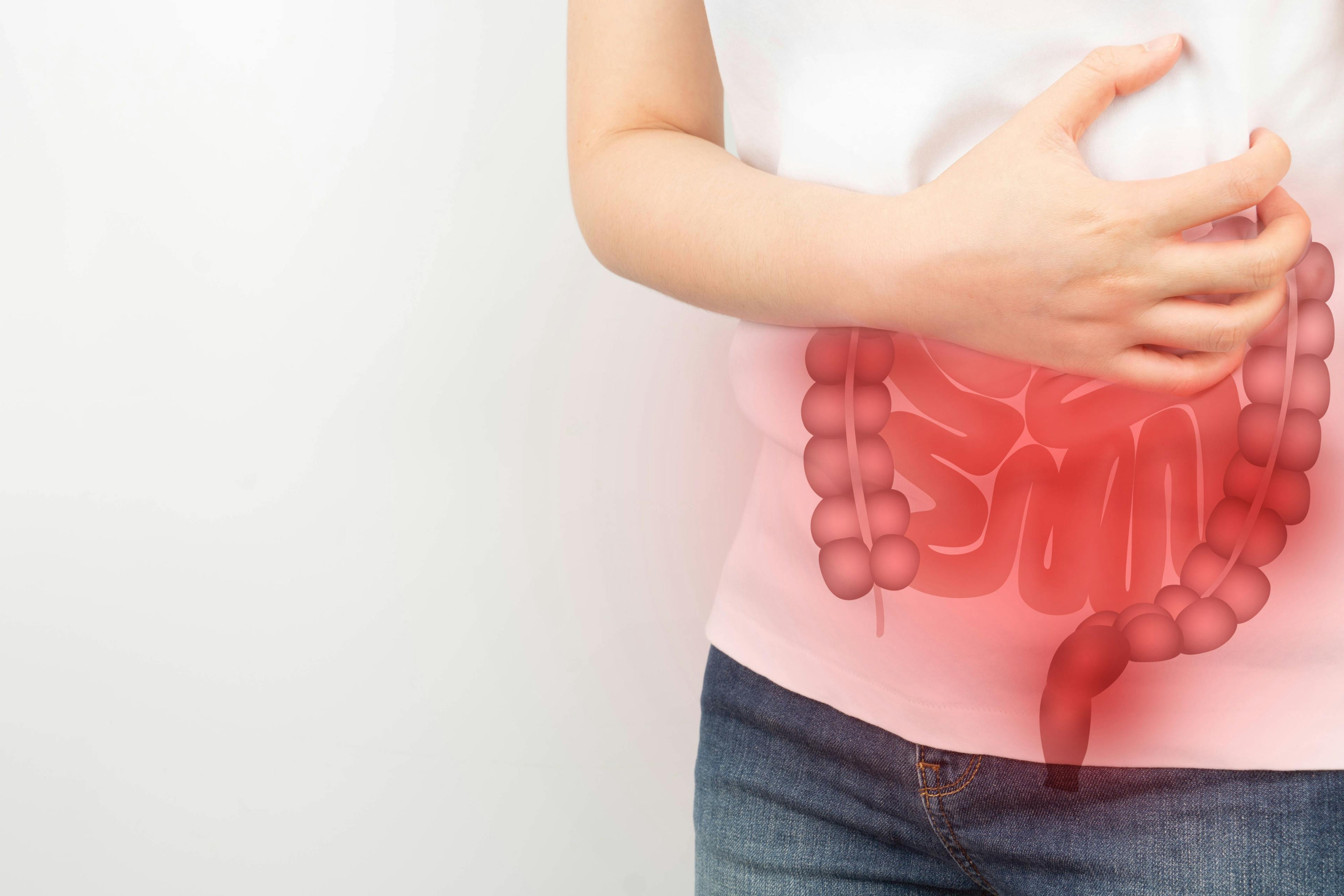 FDA Approves First-in-Class Therapy for Ulcerative Colitis 