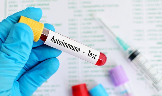 Autoimmune drug pipeline highlights
