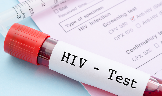 HIV test of blood in vial