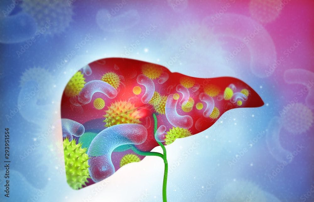 Antivirals Reduce Liver Disease Progression in Hepatitis C patients